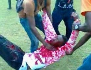 UNILAG Student Shot By Unknown Gunmen