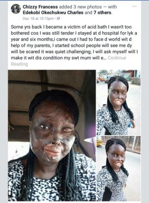 "Having a Scar On Your face Doesn't Stop You From Shining"- Corp Member Celebrates Her Progress