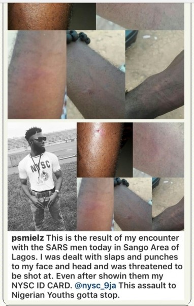 "I Give Up On This Country" A Corp Member Exclaimed After He Was Beaten By SARS