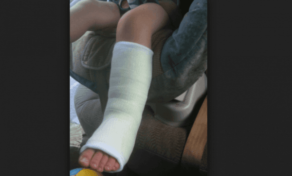 School Owner Flogs, Breaks Pupil's Leg