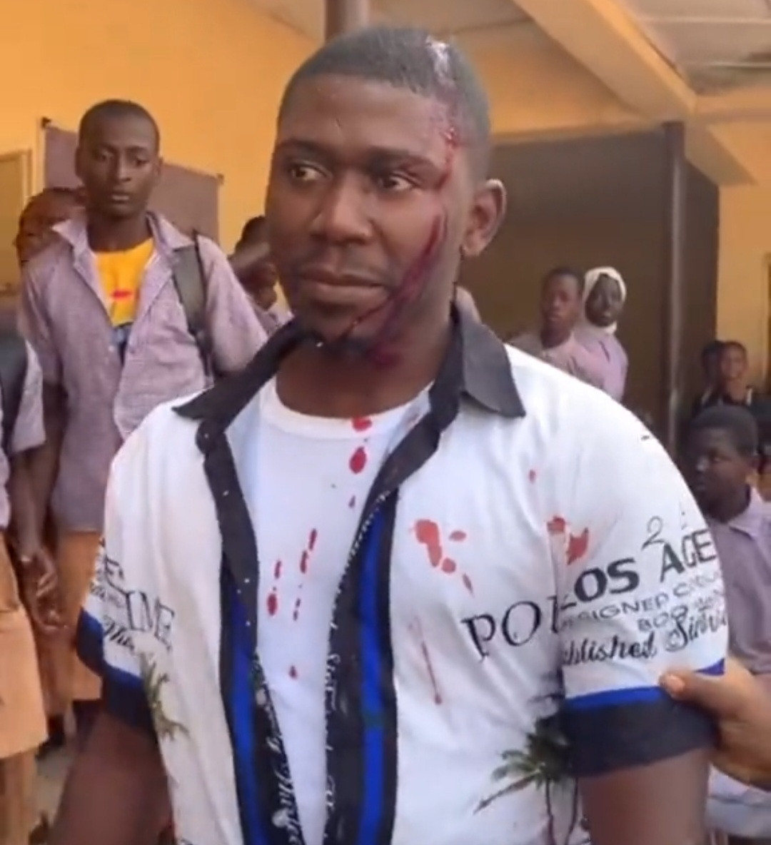 Corps member bleeds from the head after being attacked by students at the secondary school he was posted to in Osun State 