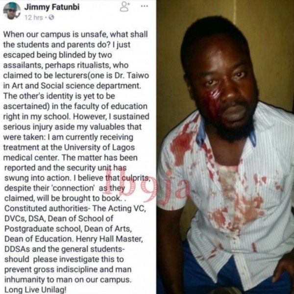 Student Of UNILAG Survives Ritualist Attack On Campus.