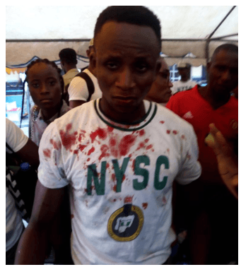 National Youth Corps Member Beaten Up During Election in Lagos