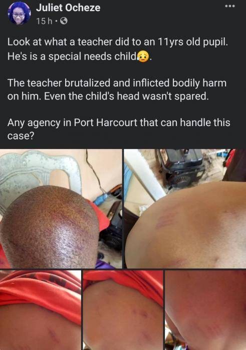 Port Harcourt teacher accused of assaulting a special needs student