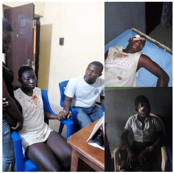 SS1 Female Stabs Classmate In The Eye For Refusing To Join Cult in Otuoke - Graphic Image Inside